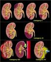 traumakidney1